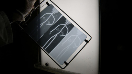 x ray museum of London Xray 2.jpg